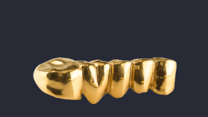 золотые зубные мосты